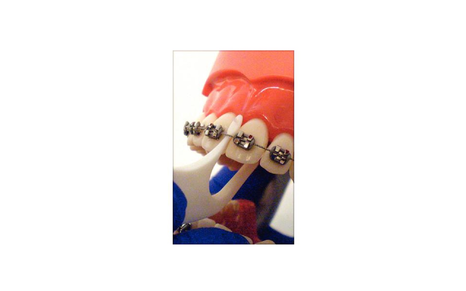 Platypus® Orthodontic Flossers - Platypus Co