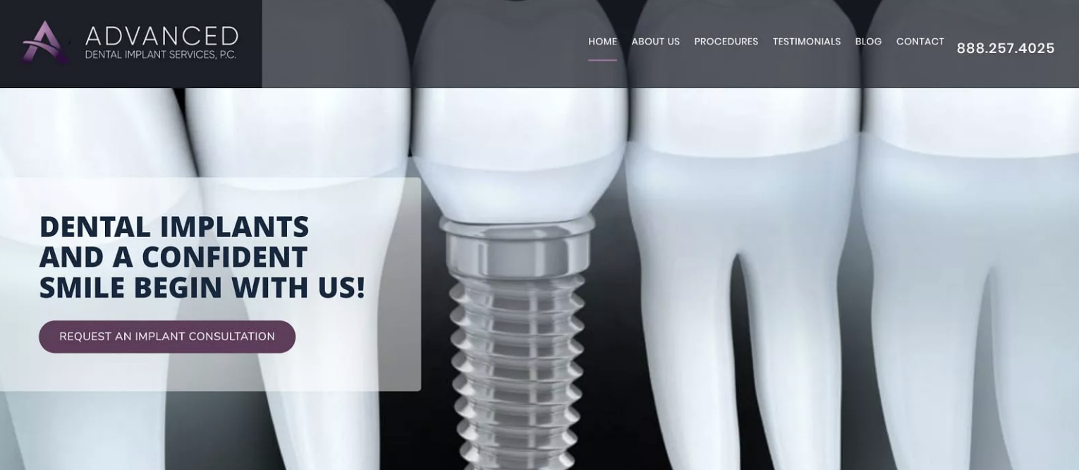 dental implants placed by a surgeon